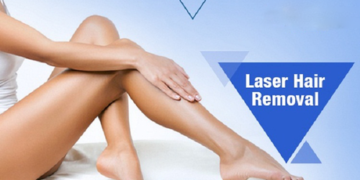 Laser hair removal services