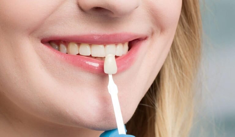 Know what dental veneers can do for your smile! Know what dental veneers can do for your smile!