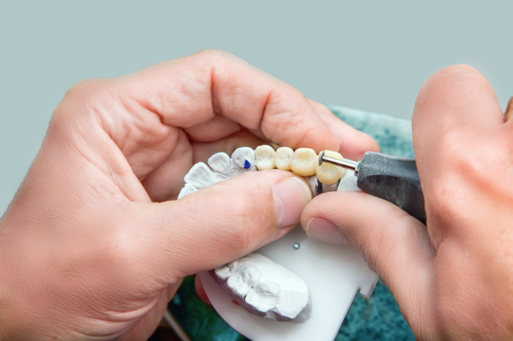 Dental Implants