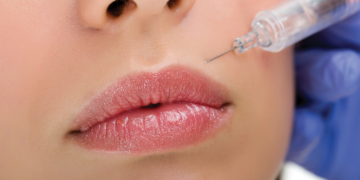 Is Botox Safe