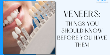 veneers procedure
