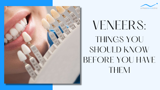 Veneers: Things You Should Know Before You Have Them