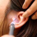 Problems earwax can cause