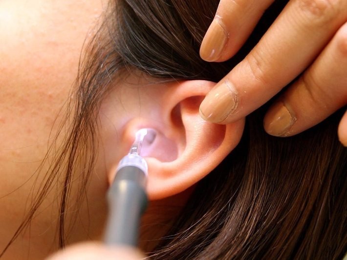 Problems earwax can cause