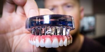 Full Mouth Dental Implants