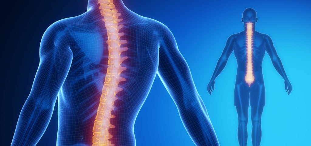 Scoliosis Specialist