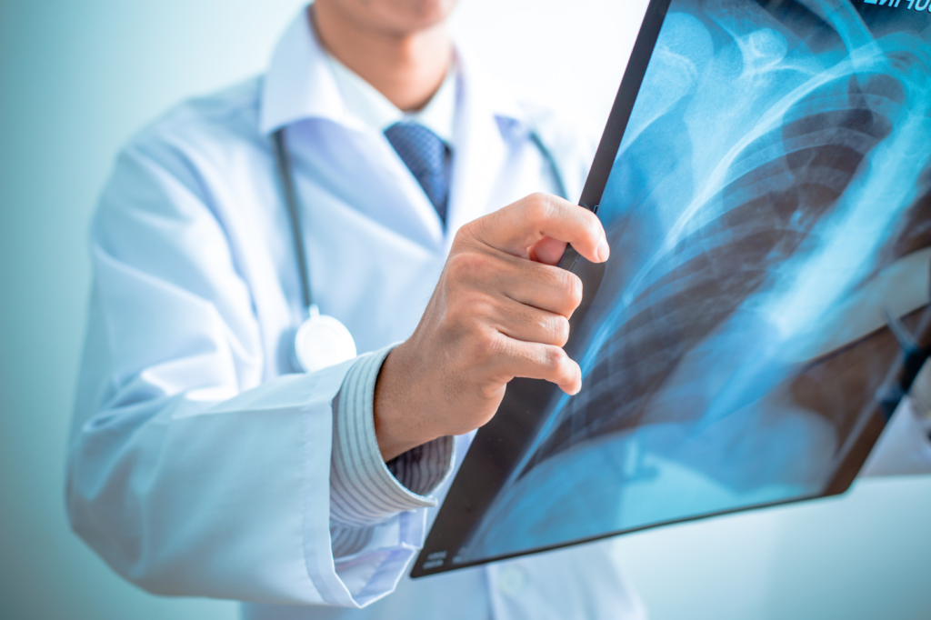 musculoskeletal health problems