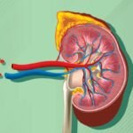 Can High Blood Pressure Damage Your Kidneys?