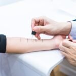 Allergy Testing in Singapore