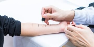 Allergy Testing in Singapore