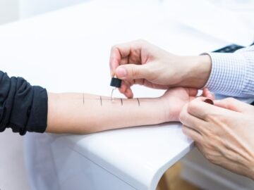 Allergy Testing in Singapore