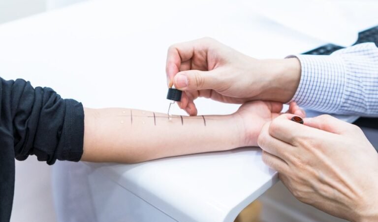 All About Allergy Testing in Singapore: A Comprehensive Guide