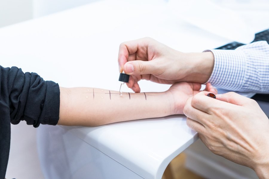 Allergy Testing in Singapore
