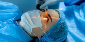 Cataract Surgery