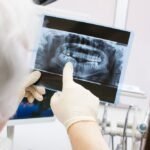 Dental X-Rays