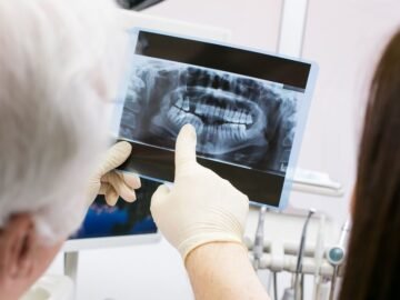 Dental X-Rays