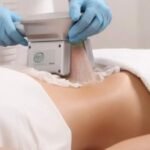 Cryolipolysis