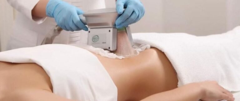 Cryolipolysis