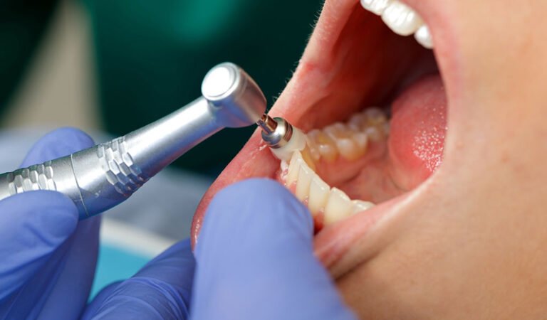 What to Expect During a Routine Dental Cleaning