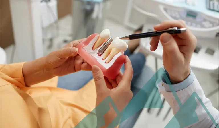 How Long Do Dental Implants Last? A Comprehensive Look