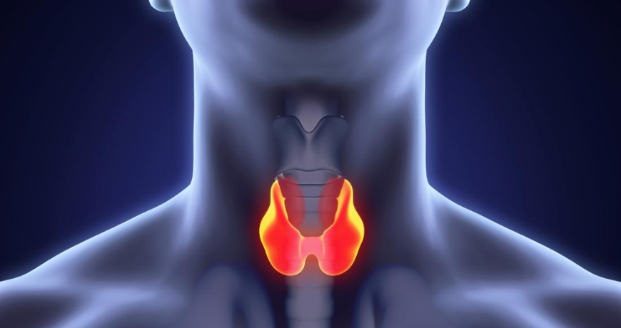 Thyroid Cancer