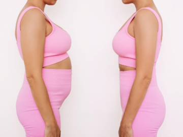 Liposuction and Breast Augmentation