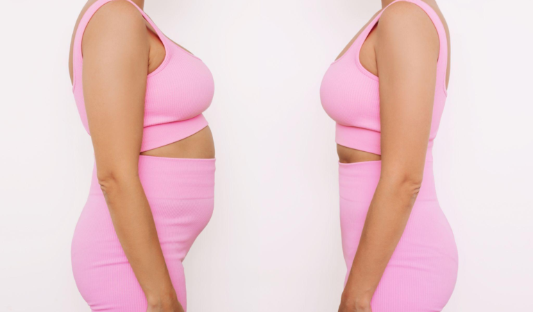 Transform Your Look with a Combined Liposuction and Breast Augmentation Procedure in Mumbai