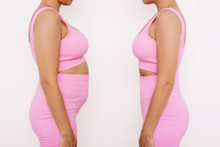 Liposuction and Breast Augmentation