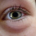 Cocaine Pupils