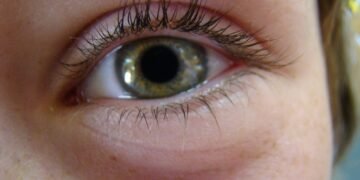 Cocaine Pupils