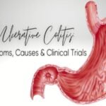 Ulcerative Colitis Clinical Trials