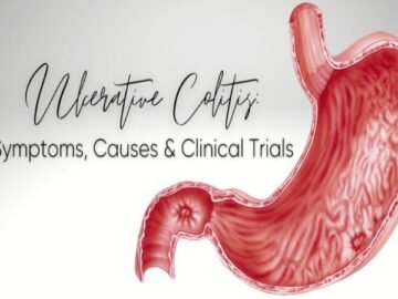Ulcerative Colitis Clinical Trials