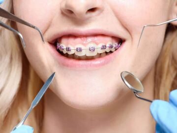 Orthodontics