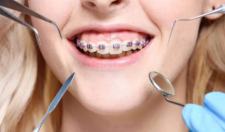 Why Do Leading Orthodontics in Durham Recommend Clear Aligner Solutions?