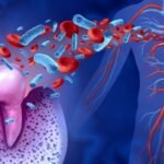 Systemic Diseases
