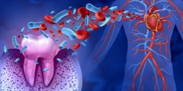Systemic Diseases