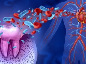 Systemic Diseases