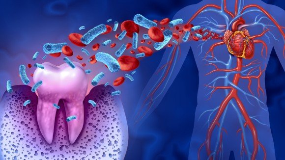 Systemic Diseases