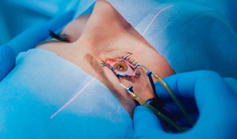 LASIK Eye Surgery in NYC – Top-Rated Vision Correction Experts