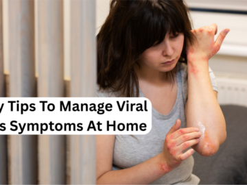 Viral Hives
