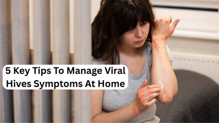 Viral Hives