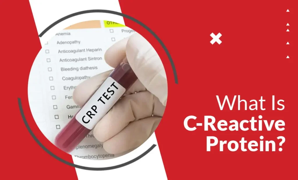 C-Reactive Protein (CRP) Test