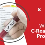 C-Reactive Protein (CRP) Test