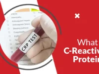 C-Reactive Protein (CRP) Test