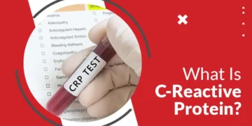 C-Reactive Protein (CRP) Test