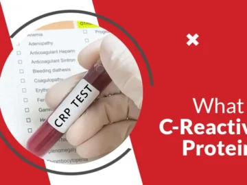 C-Reactive Protein (CRP) Test