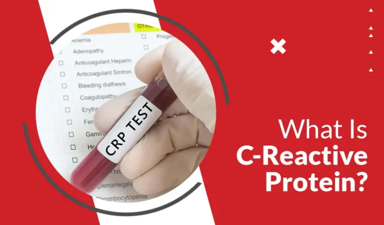 C-Reactive Protein (CRP) Test: What It Is, When to Take it, and How to Read Your Report