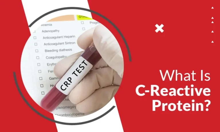 C-Reactive Protein (CRP) Test
