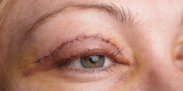 Eyelid Lift Surgeon