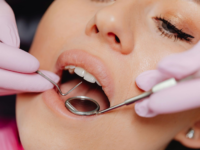 Preventive Dentistry Is Key To Preserving Natural Teeth